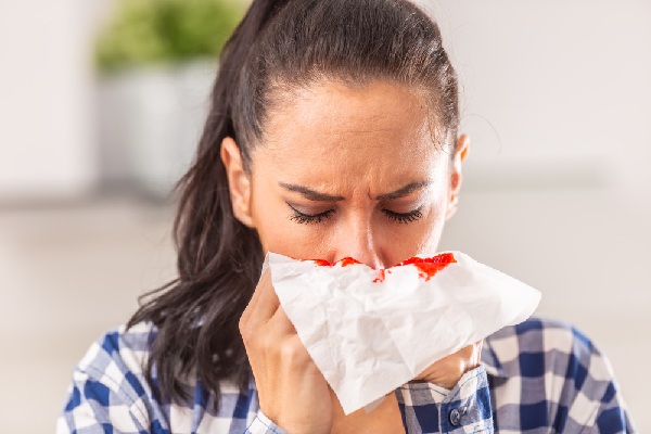 Treatment of Nose Bleeding